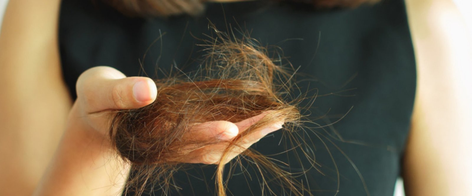 Is diet-related hair loss reversible?