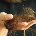 Will hair loss from weight loss grow back?